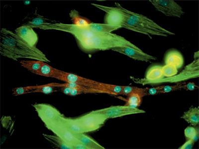 Myoblasts